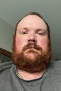 Dennis